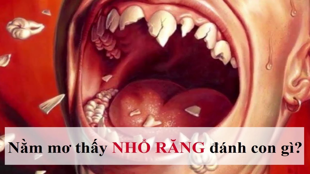 nam-mo-thay-nho-rang-danh-con-gi